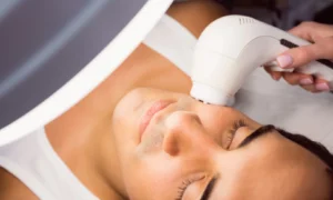 IPL e hiperhidrosis: dos tratamientos médico-estéticos que mejoran bienestar y confianza